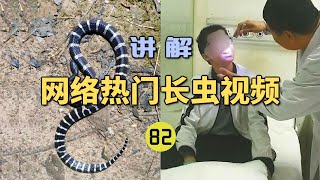 4K  网络热门长虫视频82年仅13岁男孩网购银环蛇当宠物？刚买来就被咬进ICU险些丧命！【世界记忆大师龙雅】 [upl. by Inahet]