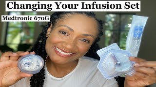 Changing your Infusion Set Medtronic 670G [upl. by Ardnola]