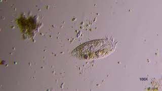 Stylonychia Ciliate under microscope [upl. by Nimzzaj834]