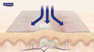 Hansaplast Narben Reduktion [upl. by Pfaff]