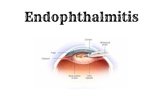 ENDOPHTHALMITIS Explained in 2 minutes [upl. by Assiralk515]