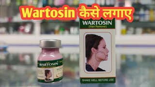 Wartosin Wart Remover l Wartosin kaise Lagaye l Price  Uses in Hindi l How to Use l [upl. by Alsi]