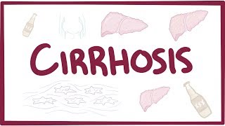 Cirrhosis  causes symptoms diagnosis treatment pathology [upl. by Yrram620]