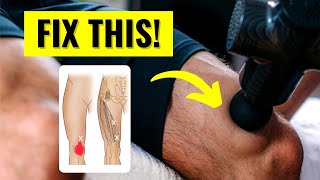 Science Confirms Treating This STOPS Knee Arthritis Pain [upl. by Roots99]