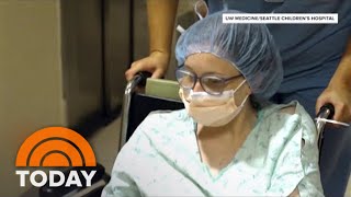 Survivor Of Conjoined Twin Surgery Gives Birth To Her Own Baby [upl. by Lazaro]