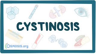 Cystinosis  causes symptoms diagnosis treatment pathology [upl. by Inessa834]