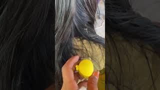 I Removed Lice and Nits from My Scalp for 30 Days Heres What Happened [upl. by Yatnod]