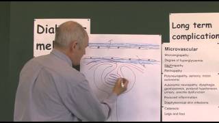 Diabetes 19 Microvascular Complications [upl. by Dichy]