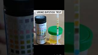 Urine dipstick test [upl. by Blount]