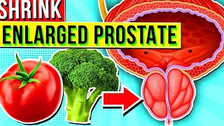 Warning 6 Foods to Avoid Absolutely for Preserving Your Prostate  Enlarged Prostate [upl. by Eiger817]