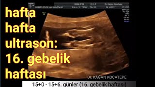 16 gebelik haftasında anne karnındaki kız bebek  açıklamalı ultrason görüntüleri [upl. by Ettenoitna]