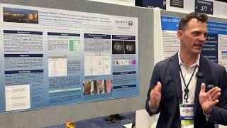 Andrew Brohl at ASCO 2024  Abstract 9592 [upl. by Ariayek895]