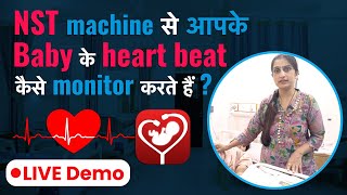 NST Machine से Baby की Heart Beat Monitor कैसे करते है   How to Monitor Babys Heartbeat with NST [upl. by Dat]