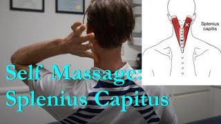 Self Massage Splenius Capitus back of neck [upl. by Silden727]