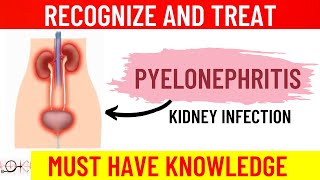 What is Pyelonephritis  All you need to know  Causes  Symptoms  Diagnosis  Treatment [upl. by Orgel]