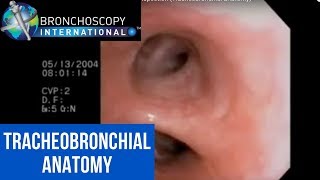 Flexible Bronchoscopy Introduction 7  Airway Inspection Tracheobronchial Anatomy [upl. by Norman]