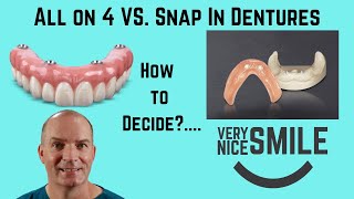 All on 4 or Snap in dentures Some points to consider [upl. by Ilarin912]