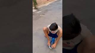 Skating nhi chals sakta yaar 🥺😭 skating mahiskates accident inlineskating trending [upl. by Derrik136]