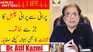 Chambal Ka llaj  Eczema Ka Ilaj  How To Treat Eczema  Eczema Treatment  Dr atif kazmi [upl. by Cordell798]