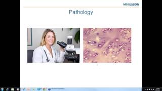 Mastering ICD10CM for Radiology Pathology and Lab Webinar [upl. by Henryetta]