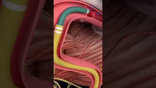 Stroke Treatment Mechanical Thrombectomy Medical Animation Enhanced Version ischemicstroke [upl. by Elleira]