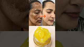 Turmeric Cream to remove pigmentation acne scars dark spots ashortaday trending [upl. by Belvia]