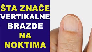 Šta znače VERTIKALNE BRAZDE NA NOKTIMAdr Bojana Mandić [upl. by Shanney]