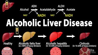 Alcoholic Liver Disease Animation [upl. by Anuqahs75]