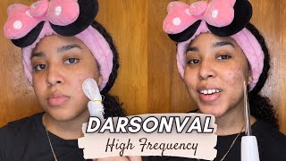 1 HIGH FREQUENCY from Darsonval skincare [upl. by Araes]