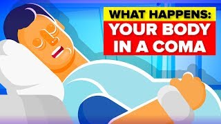 What Happens To Your Body in a Coma [upl. by Enytsuj]