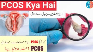 PCOS Kya Hai  Urdu Hindi  PCOS Causes amp Symptoms  Polycystic Ovaries  Health amp Medical Care 🌐 [upl. by Roach]