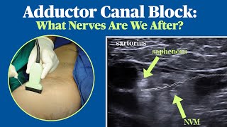 Adductor Canal Block What Nerves Are We After [upl. by Einaoj]