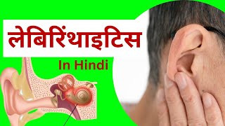 लैबिरिंथाइटिस  कारण लक्षण प्रबंधन  nursing notes in hindi  labyrinthitis in hindi [upl. by Jaunita]