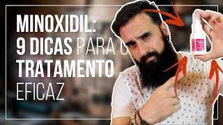 MINOXIDIL 9 DICAS para um tratamento EFICAZ [upl. by Chick413]