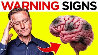 The Silent Symptoms of Dementia Watch Out for These 6 Warning Signs [upl. by Neelram154]