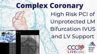 High Risk PCI of Unprotected LM Bifurcation IVUS and LV Support  January 16 2018 [upl. by Eceinal281]