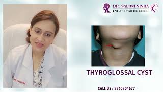 Neck Swelling DrSaloni SinhaThyroglossal CystThyroglossal Fistula [upl. by Wiese]