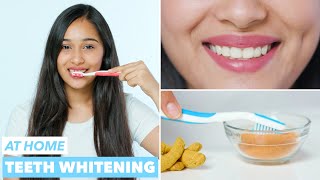 Easy Teeth Whitening at Home [upl. by Tomasz]