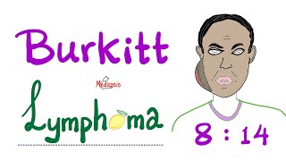 Burkitt’s Lymphoma  Aggressive BCell Neoplasm  NonHodgkin’s Lymphoma  Fastest Growing Cancer [upl. by Mandel]