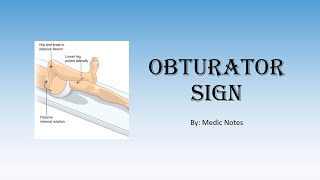 Obturator sign pathophysiology [upl. by Revlis]