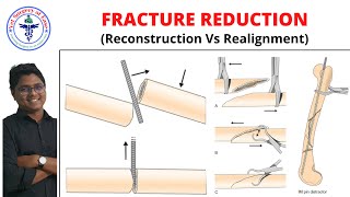 FRACTURE REDUCTION  Lecture 04  Orthopedics [upl. by Esila733]