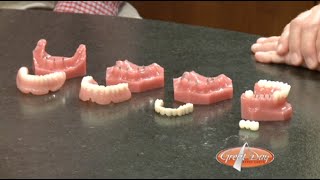 Mini Dental Implants How They Work [upl. by Rapsac20]