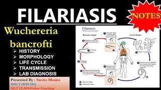 FILARIASIS  Wuchereria Bancrofti microbiology Parasitology 💥 full details MLTclass [upl. by Pillihpnhoj]