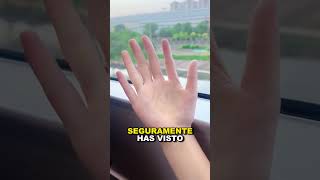 Dedo adicional en acción 😨 POLIDACTILIA shorts viral [upl. by Waal]