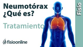 Neumotórax Qué es consejos y tratamiento a través de la fisioterapia respiratoria [upl. by Anairdna]