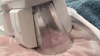 Cryolipolysis Fat Freezing Video [upl. by Zirtaeb]