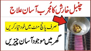 Chambal Ka Shafi ilaj  Easy Home Remedies for Psoriasis  چنبل کو آسان مجرب علاج  Happy Life [upl. by Elrak]