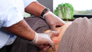 Dry Needling of Quadratus Lumborum by Dr Peter Selvaratnam AM Founder MSSM [upl. by Aztiley224]