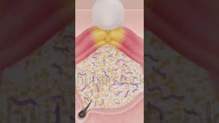 integumentary system mcqsESICNORCETAIIMSNURSING OFFICERS biology [upl. by Ytsirhc]