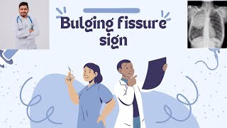 Bulging fissure sign [upl. by Kokaras]